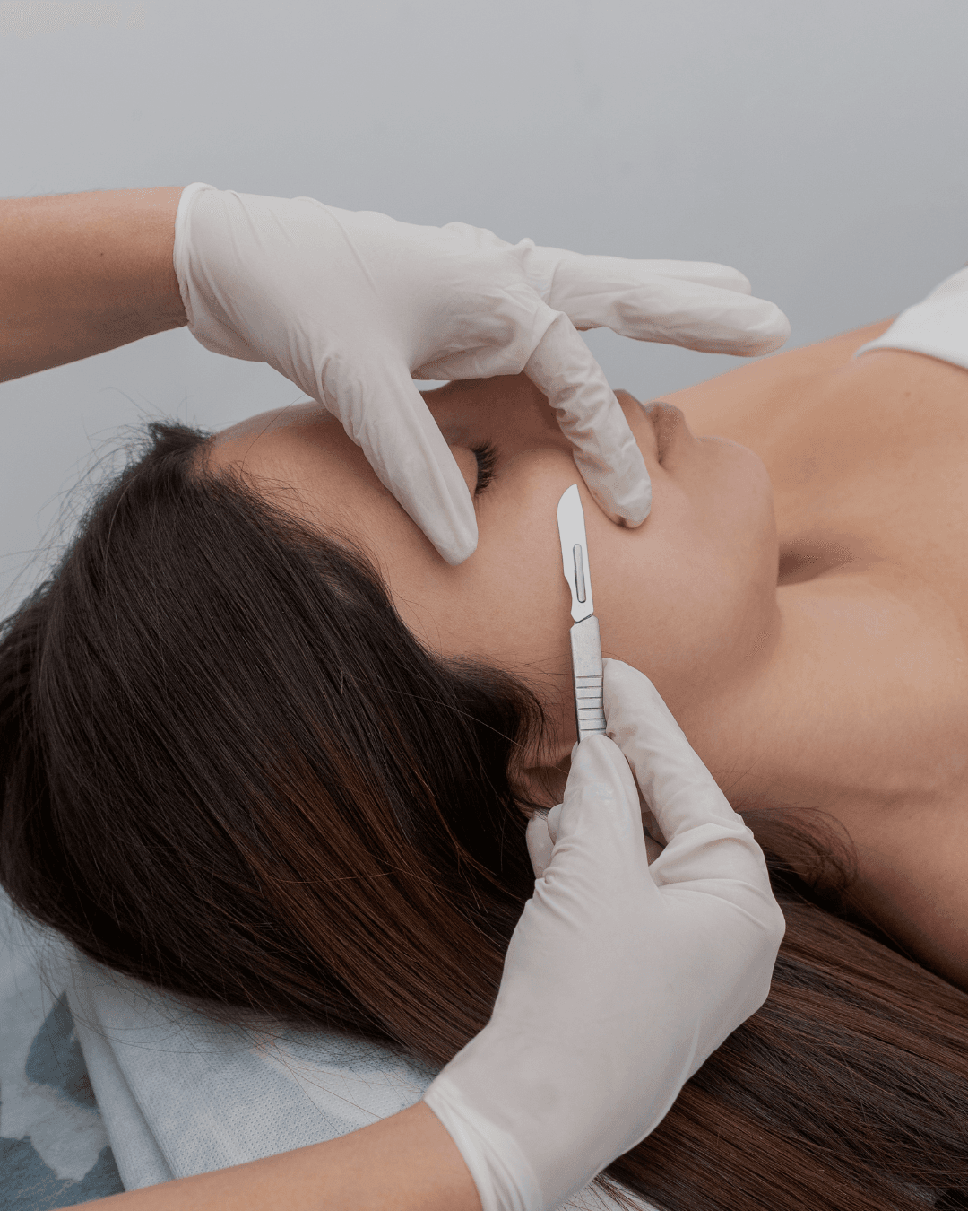 Dermaplaning treatment at Laser and Aesthetic Center