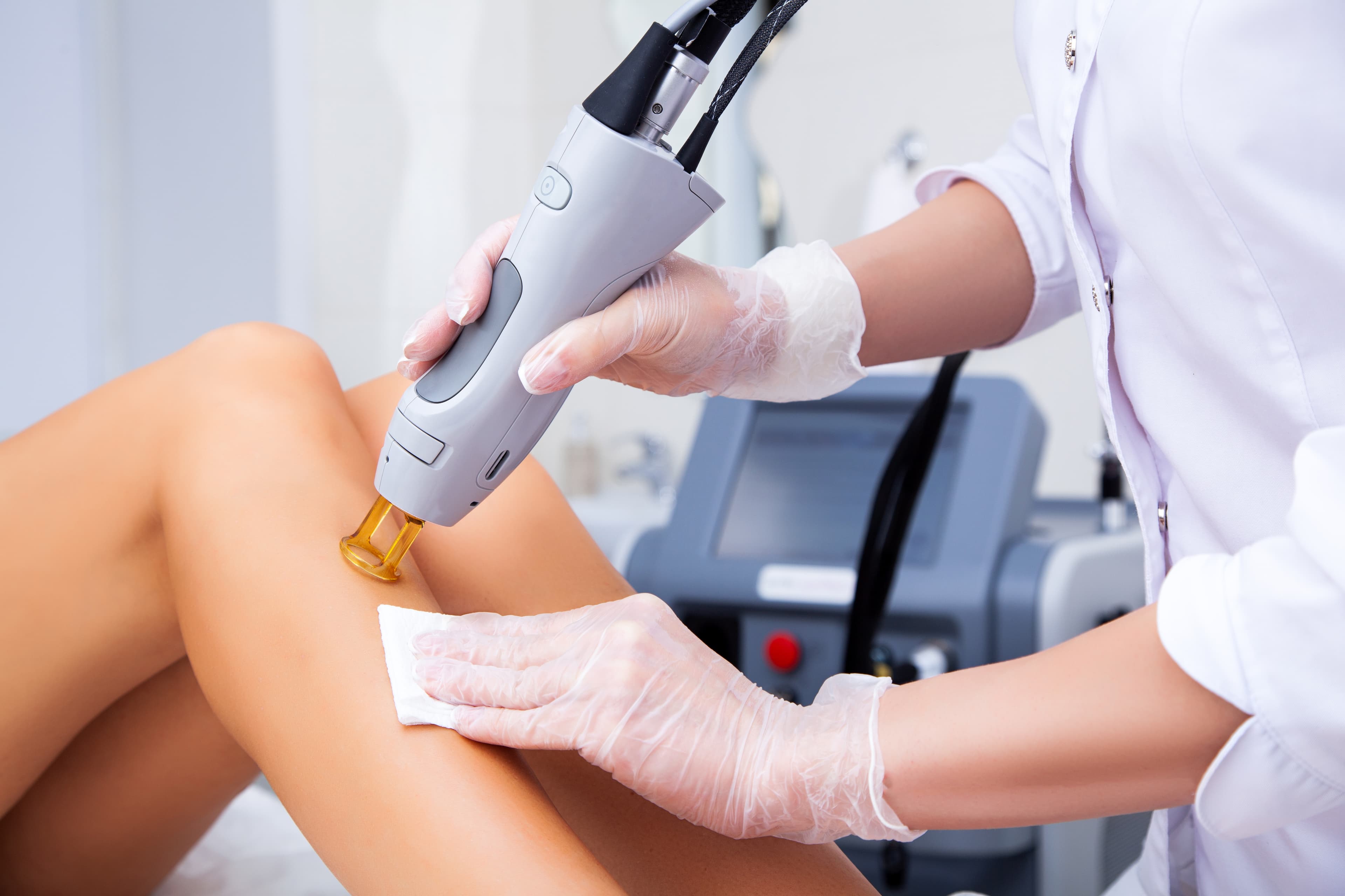 Laser hair removal treatment on leg at Laser and Aesthetic Center